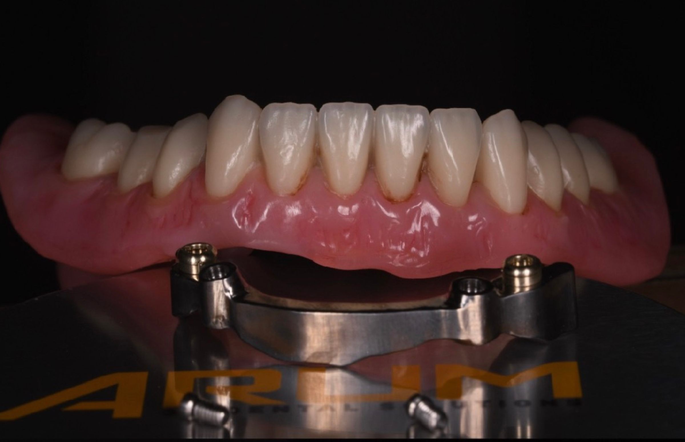 Dental-circus - Branemark , Branemarkuv most, all on 4, All on 5, All on 6, All on X, Hybridní náhrady, třmen na implantátech, zubní laboratoř, zubní technik,