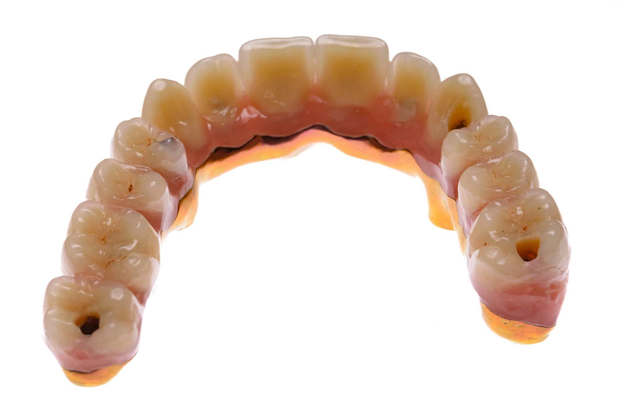 Dental-circus - Branemark , Branemarkuv most, all on 4, All on 5, All on 6, All on X, Hybridní náhrady, třmen na implantátech, zubní laboratoř, zubní technik,