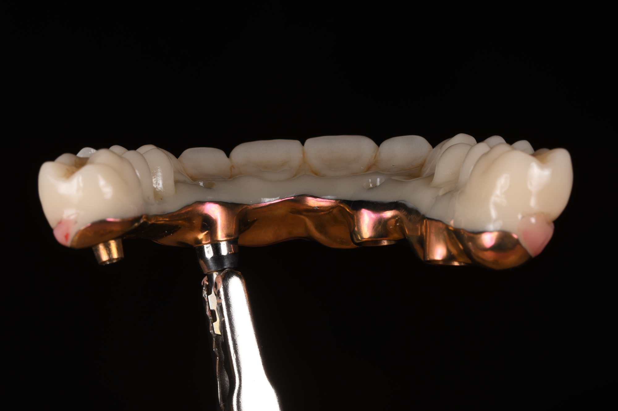 Dental-circus - Branemark , Branemarkuv most, all on 4, All on 5, All on 6, All on X, Hybridní náhrady, třmen na implantátech, zubní laboratoř, zubní technik,