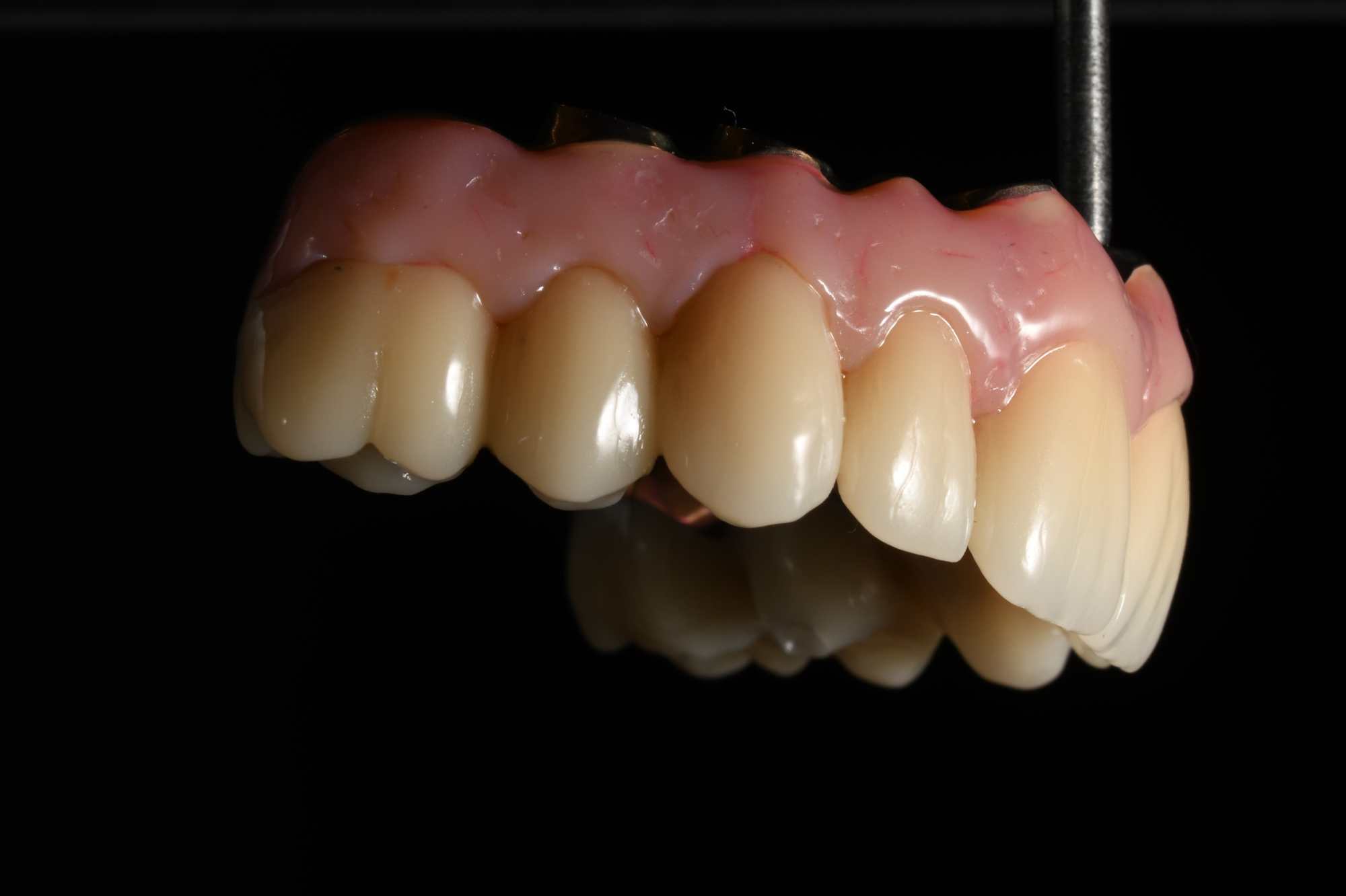 Dental-circus - Branemark , Branemarkuv most, all on 4, All on 5, All on 6, All on X, Hybridní náhrady, třmen na implantátech, zubní laboratoř, zubní technik,