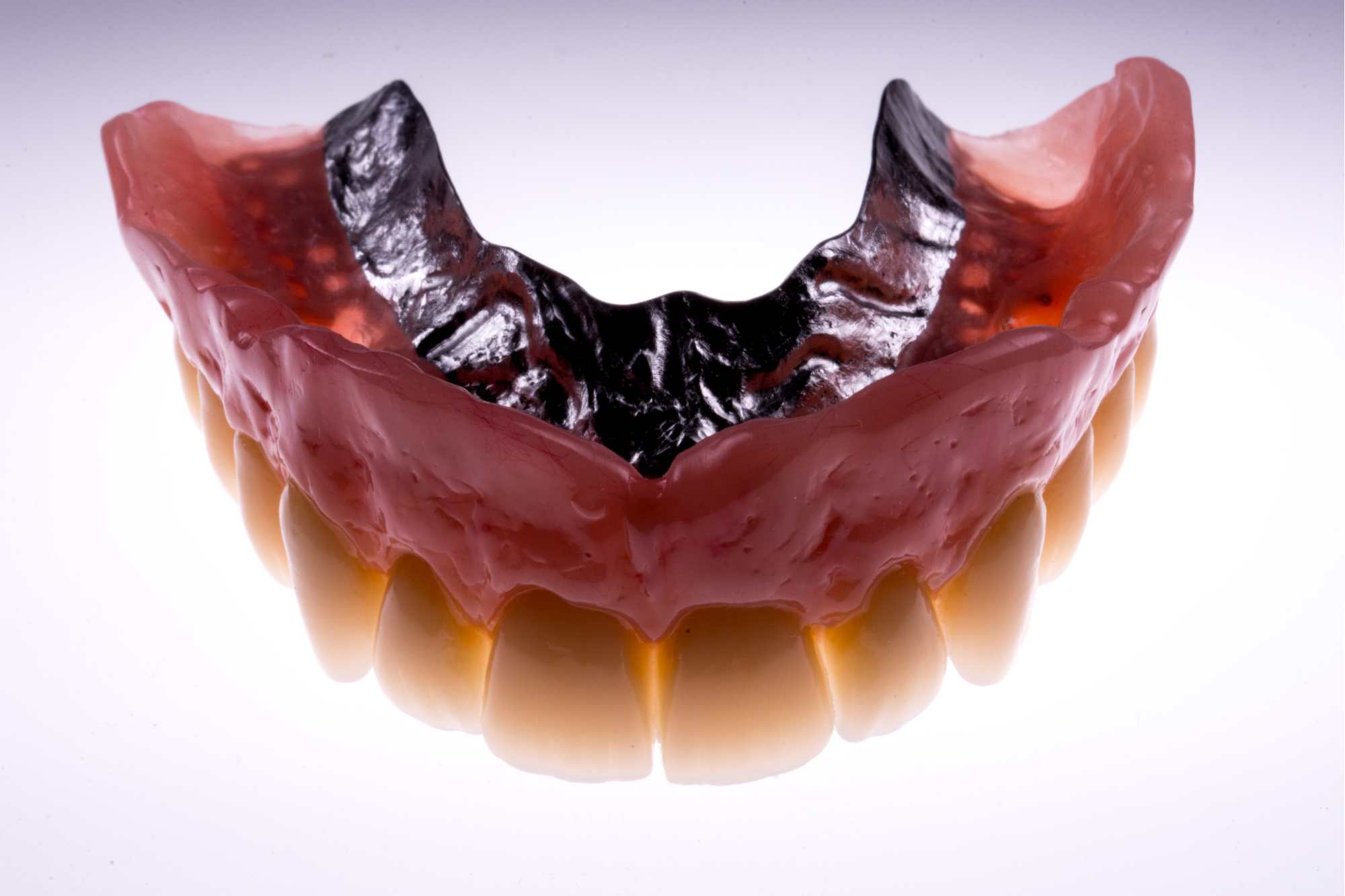 Dental-circus - Branemark , Branemarkuv most, all on 4, All on 5, All on 6, All on X, Hybridní náhrady, třmen na implantátech, zubní laboratoř, zubní technik,