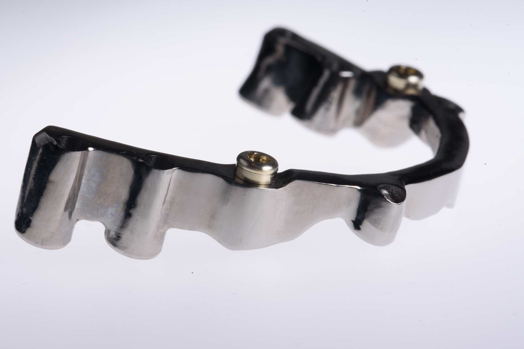 Dental-circus - Branemark , Branemarkuv most, all on 4, All on 5, All on 6, All on X, Hybridní náhrady, třmen na implantátech, zubní laboratoř, zubní technik,