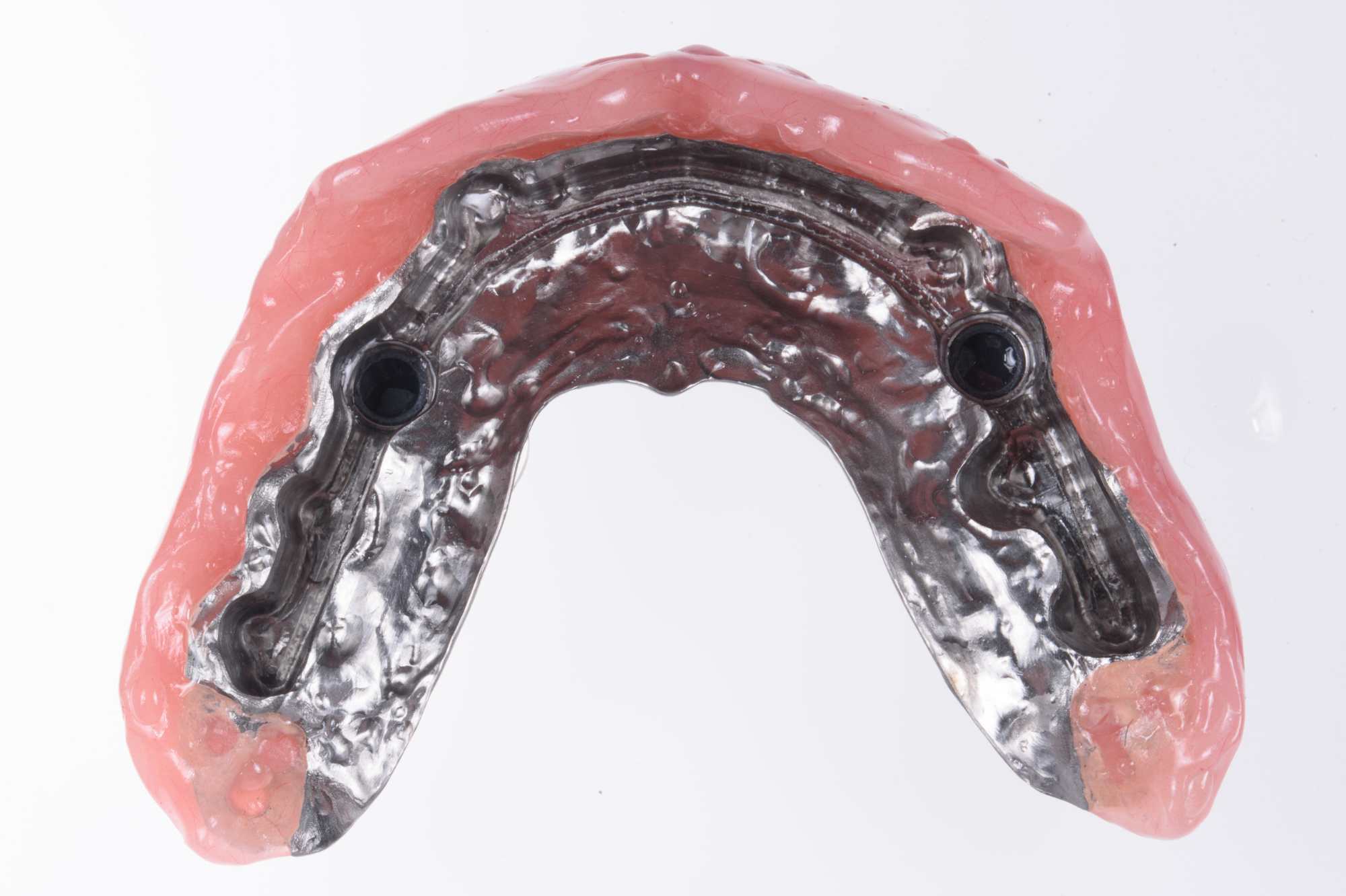 Dental-circus - Branemark , Branemarkuv most, all on 4, All on 5, All on 6, All on X, Hybridní náhrady, třmen na implantátech, zubní laboratoř, zubní technik,