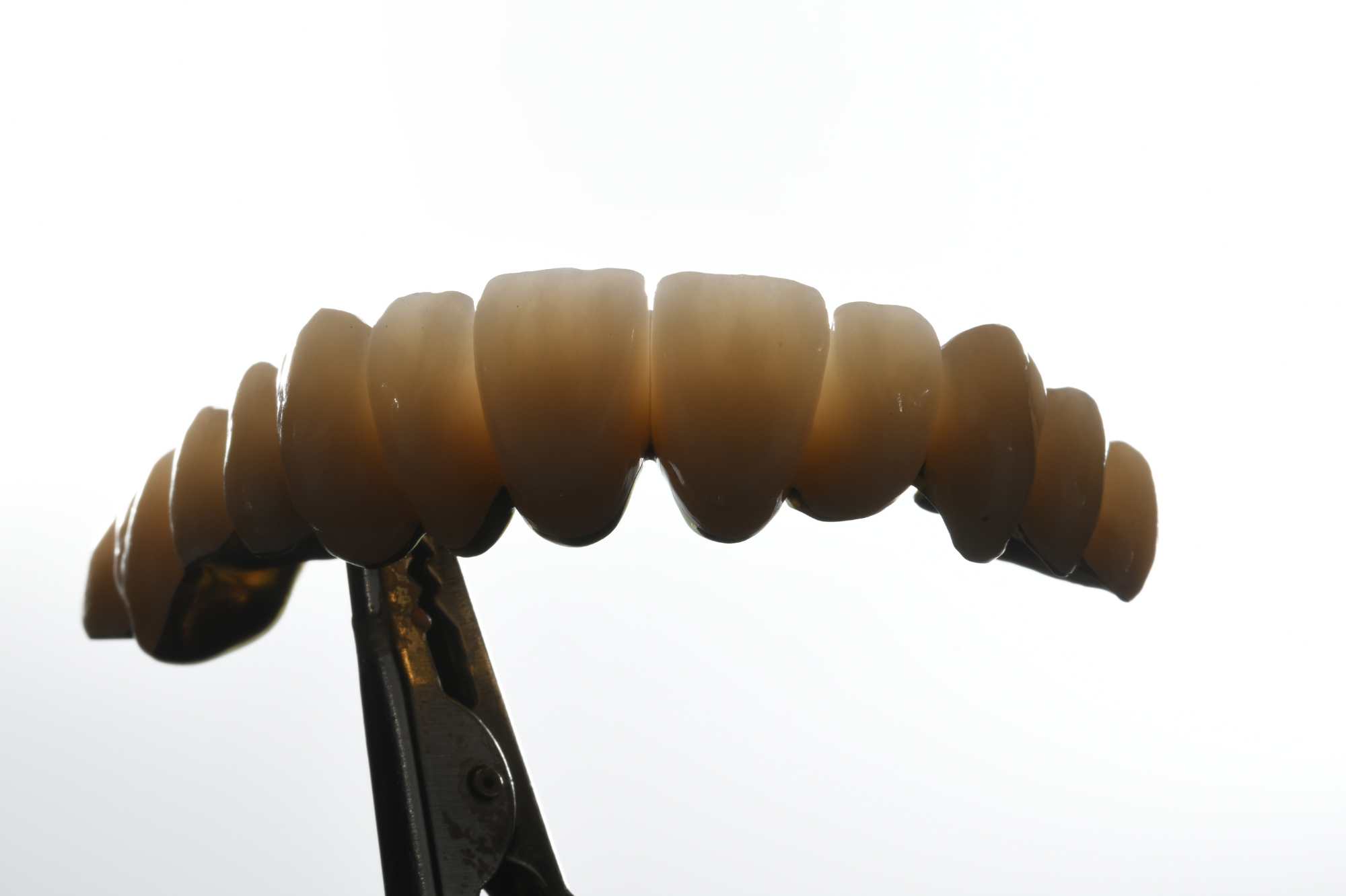 Dental-circus - Branemark , Branemarkuv most, all on 4, All on 5, All on 6, All on X, Hybridní náhrady, třmen na implantátech, zubní laboratoř, zubní technik,