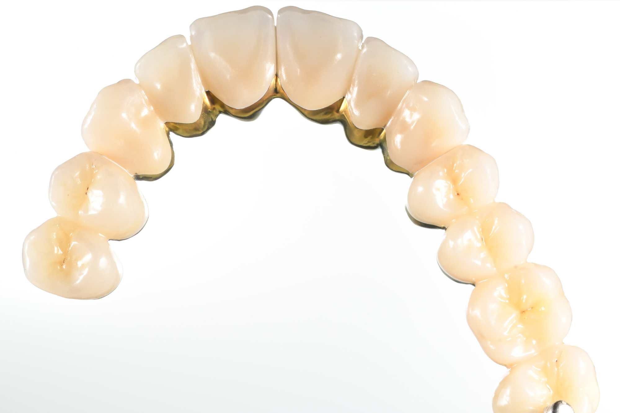 Dental-circus - Branemark , Branemarkuv most, all on 4, All on 5, All on 6, All on X, Hybridní náhrady, třmen na implantátech, zubní laboratoř, zubní technik,